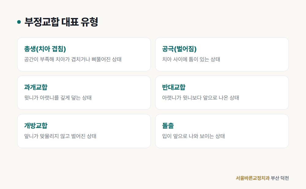 부정교합 대표 유형 도해