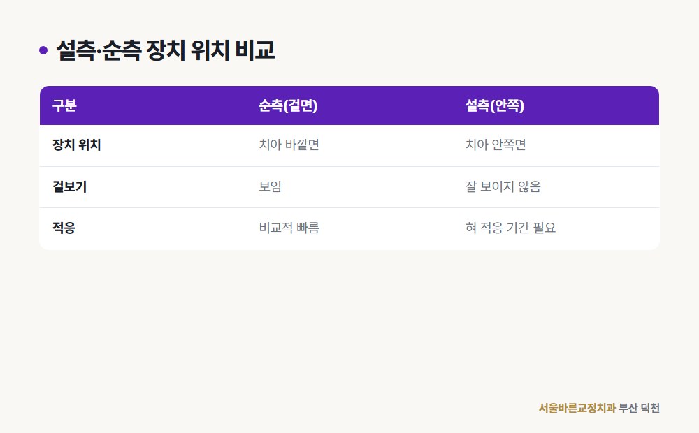 설측·순측 장치 위치 비교 도해
