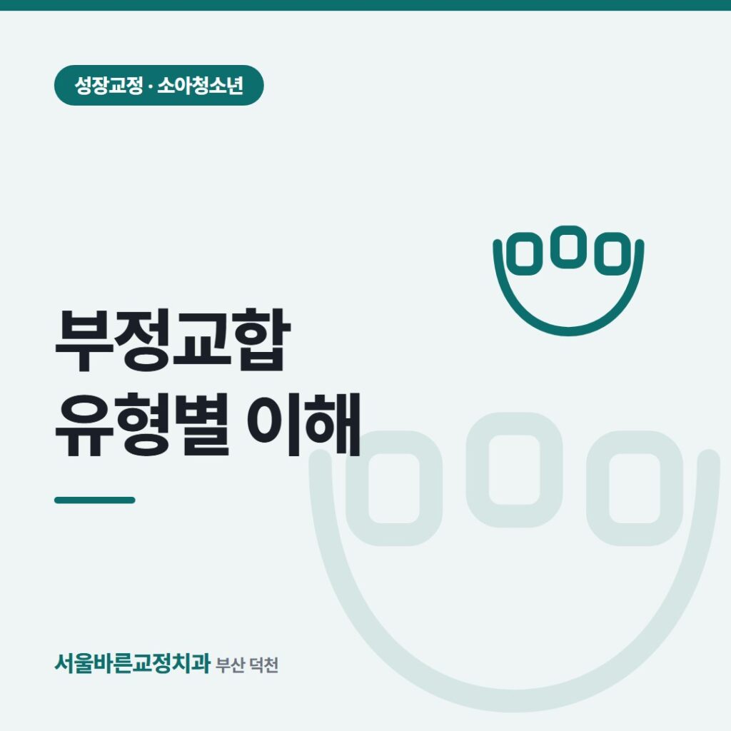 부정교합 유형별 이해 카드