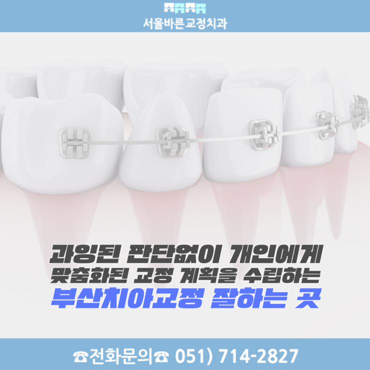 브라켓 교정장치를 표현한 치아 3D 그래픽