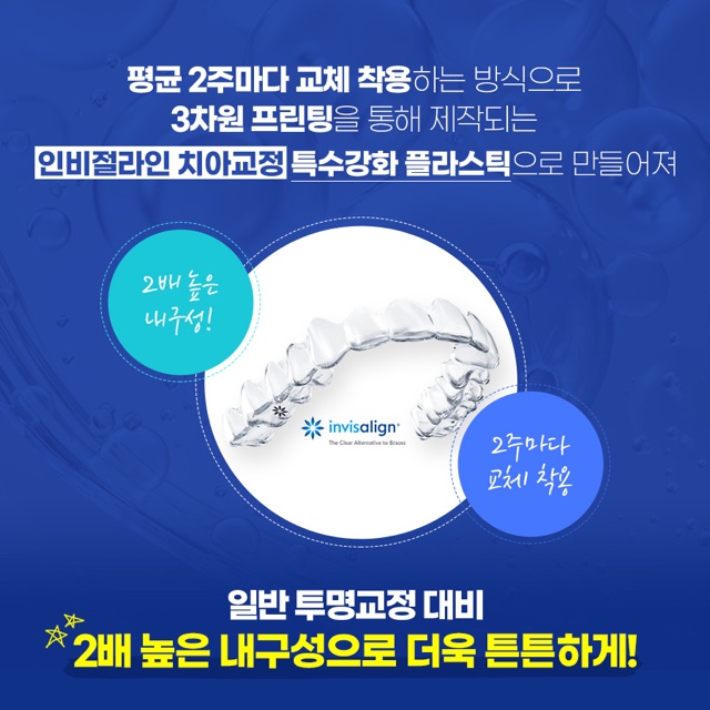 설측교정 기간과 내원 주기는 무엇이 좌우할까 — 덕천치아교정